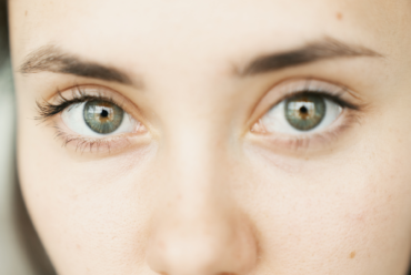 Blefaroplastyka Plasmage